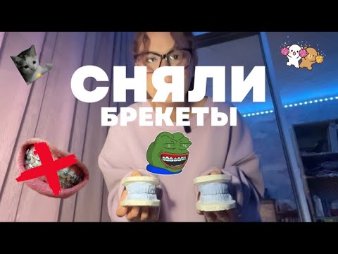 Видео: МНЕ СНЯЛИ БРЕКЕТЫ!!