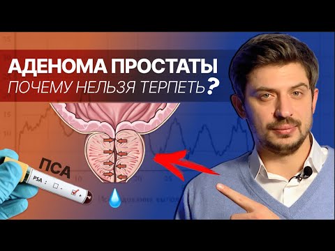 Видео: Аденома предстательной железы, высокий уровень ПСА, обследование и лечение.