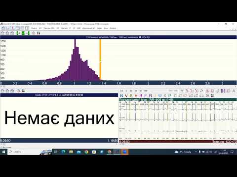 Видео: Майстер клас ECGpro Holter 24.01.2024