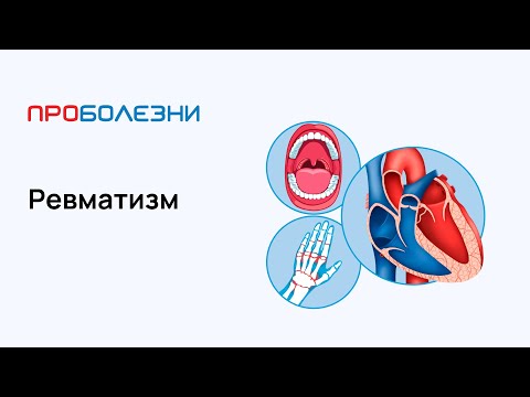 Видео: Ревматизм — острая ревматическая лихорадка