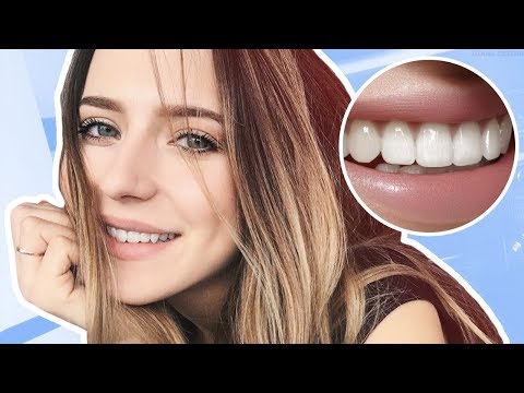 Видео: Как Добиться Красивой Улыбки? 👅