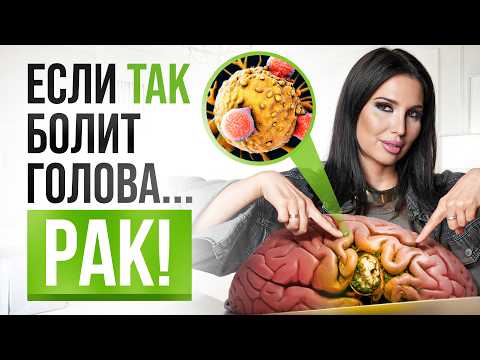 Видео: 3 признаков ОПАСНОЙ головной боли. СРОЧНО нужно обследоваться!