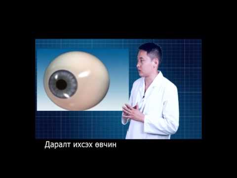 Видео: Даралт ихсэх өвчний талаар  ( Ай Ёо Доктор зөвлөж байна )