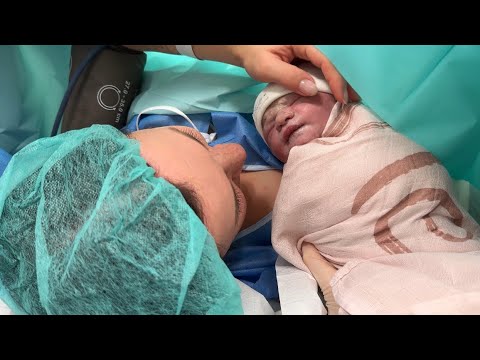 Видео: Моя история родов | Плановое кесарево сечение