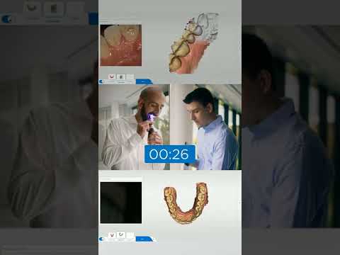 Видео: Новое ПО Connect и CEREC версии 5.2 повысило уровень производительности Primescan и CEREC Primemill