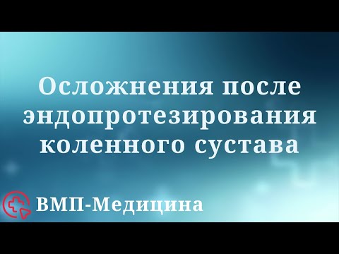 Видео: Осложнения после эндопротезирования коленного сустава | ВМП-Медицина