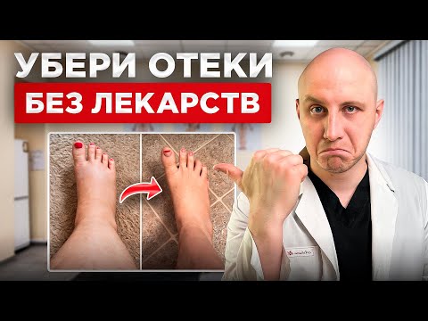 Видео: Как убрать отеки ног за неделю? Простой способ