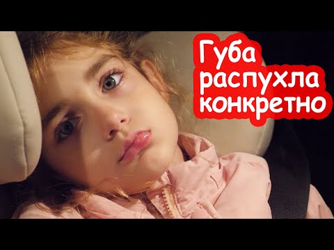 Видео: VLOG Распухшая губа и кризис пяти лет