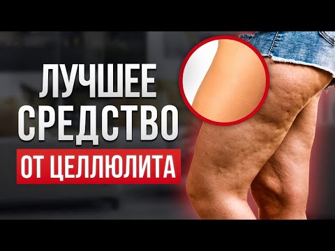 Видео: Этот способ 100 % избавит вас от целлюлита! 5 простых шагов к упругой и гладкой коже
