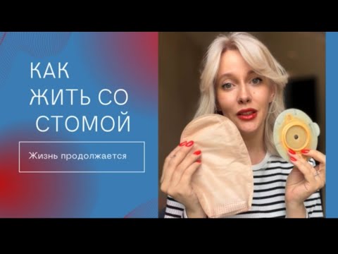 Видео: ЕДА СО СТОМОЙ. Жизнь с калоприемником. Илеостома