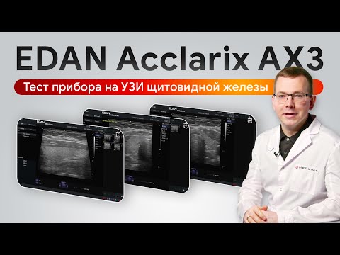 Видео: Тестируем портативный сканер EDAN Acclarix AX3: УЗИ щитовидной железы