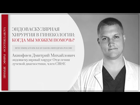 Видео: ЭМБОЛИЗАЦИЯ МАТОЧНЫХ АРТЕРИЙ ПРИ МИОМЕ МАТКИ