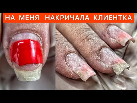 Видео: НЕВМЕНЯЕМОСТЬ НЕ ЛЕЧИТСЯ🌚ИСПРАВЛЯЮ АРХИТЕКТУРУ КВАДРАТА 💅