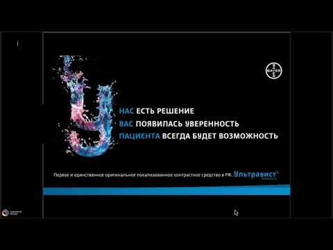 Видео: КТ сердца: родом из детства или пороки развития  которые может встретить каждый