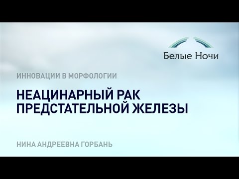 Видео: Неацинарный рак предстательной железы