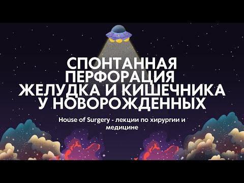 Видео: Спонтанная перфорация желудка и кишечника у новорожденных | Классификация | Диагностика | Лечение