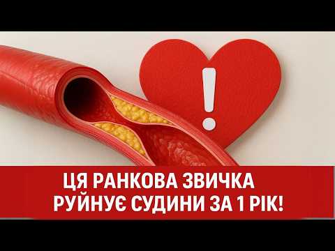 Видео: 99% людей роблять ЦЮ помилку зранку — і це руйнує судини! (Лікарі пояснюють)