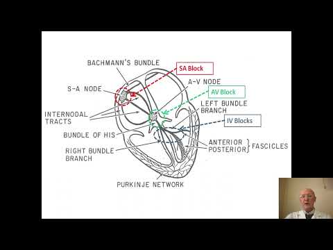 Видео: Ходунов О.Б. Блокады сердца