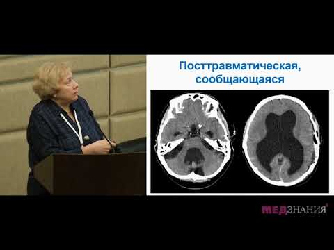 Видео: Хроническая гидроцефалия в амбулаторной практике. Н.Ю.Ермошкина