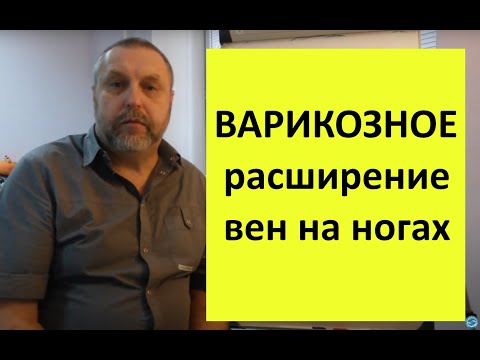 Видео: Варикозное расширение: правда и мифы