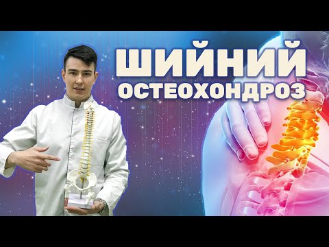 Видео: Шийний остеохондроз: причини, діагностика лікування // Шейный остеохондроз: причины, диагностика