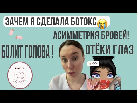Видео: Ботокс процедура и как выглядит по дням. Асимметрия бровей, болит голова.