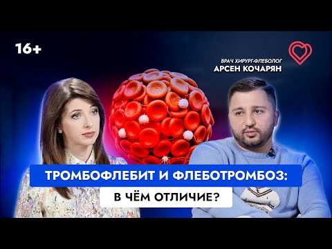 Видео: ТРОМБОФЛЕБИТ и ФЛЕБОТРОМБОЗ: в чём отличие?