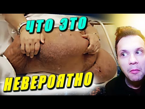 Видео: ЧТО ЭТО | Больница для толстяков выпуск 2