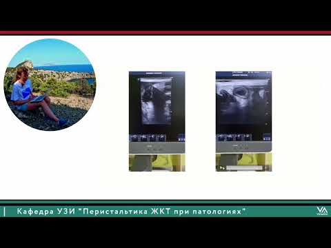 Видео: Перистальтика ЖКТ при патологиях. Кафедра УЗИ, совместно с проектом ВетАпекс