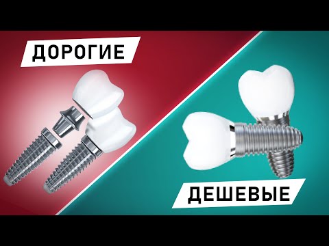 Видео: Дорогие и дешевые импланты: в чем разница? Стоит ли переплачивать?