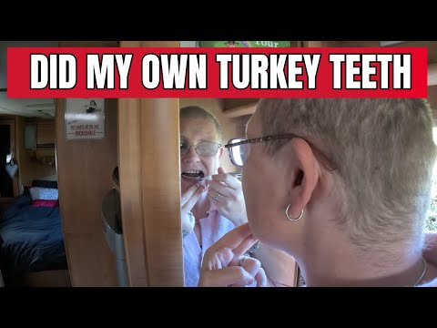 Видео: Я попробовала сама себе зубы индейки… ОГРОМНАЯ ошибка!