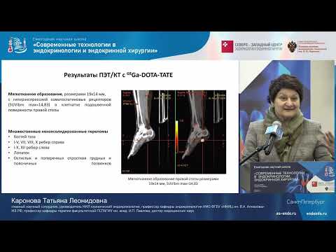 Видео: Редкие формы нарушений фосфорно-кальциевого обмена