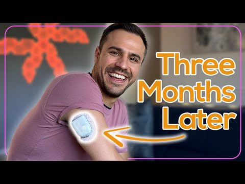 Видео: Я пользовался Omnipod 5 в течение 3 месяцев — как он сравнивается с самодельным устройством