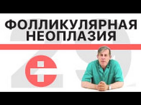 Видео: Что такое "Фолликулярная неоплазия"?
