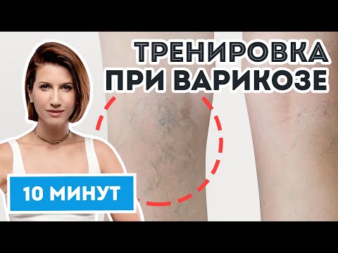 Видео: Тренировка при варикозе от Аниты Луценко: похудеть за 10 минут в день