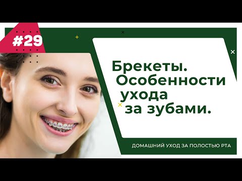 Видео: Брекеты. Урок №29 - ДОМАШНИЙ УХОД ЗА ПОЛОСТЬЮ РТА.