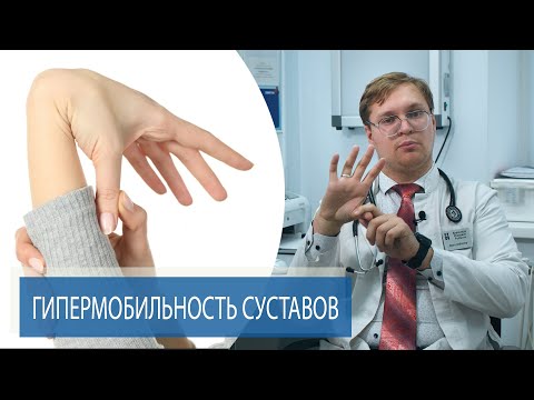 Видео: ГИПЕРМОБИЛЬНОСТЬ СУСТАВОВ | Дисплазия соединительной ткани