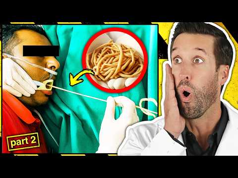 Видео: ВРАЧ смотрит на самых смертоносных паразитов, обнаруженных внутри человека (ЧАСТЬ 2)