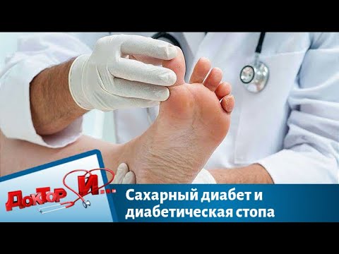 Видео: Сахарный диабет и диабетическая стопа | Доктор И