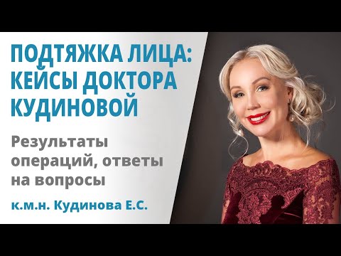 Видео: Подтяжка лица: кейсы доктора Кудиновой и ответы на вопросы