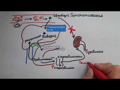 Видео: Желтуха (гемолитическая, паренхиматозная, механическая)