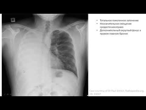 Видео: Урок №3