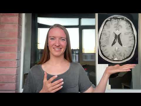 Видео: Приветствие и разбор случая "Венозная аномалия развития".