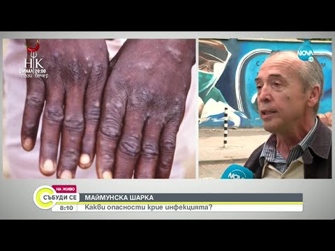 Видео: Доц. Мангъров:Опасността да се заразим с маймунска шарка е минимална - Събуди се... (22.05.2022)