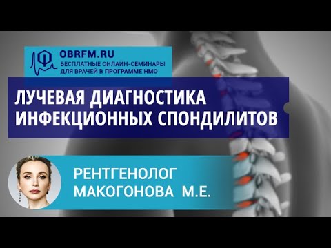 Видео: Рентгенолог Макогонова М.Е.: Лучевая диагностика инфекционных спондилитов