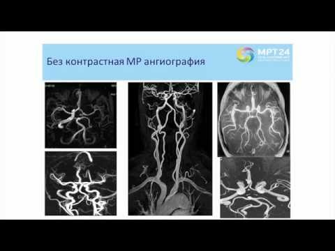 Видео: МР-визуализации в дифференциальной диагностике