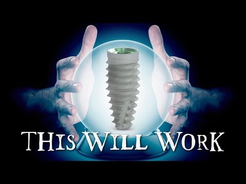 Видео: Вы можете КАЖДЫЙ РАЗ ПРЕДСКАЗЫВАТЬ первичную стабильность немедленной установки имплантатов