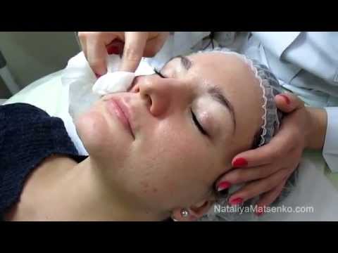 Видео: Дермапен (Dermapen) Часть 1