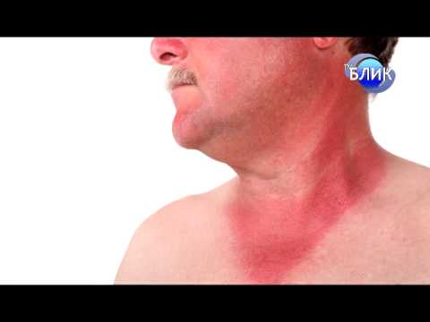 Видео: Лихорадка. Лечение. Главный врач Гаптракипов. Зав.отд.Бадретдинова Р.Ф.