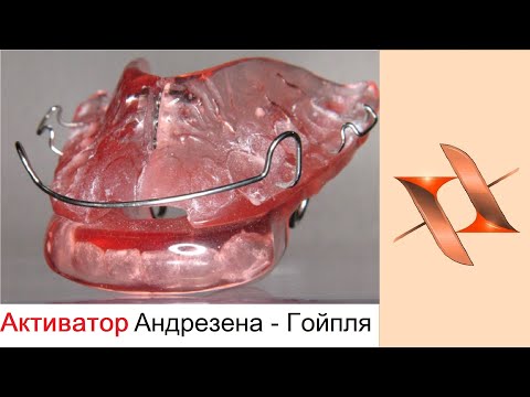 Видео: Активатор Андрезена-Гойпля. Ортодонтия.